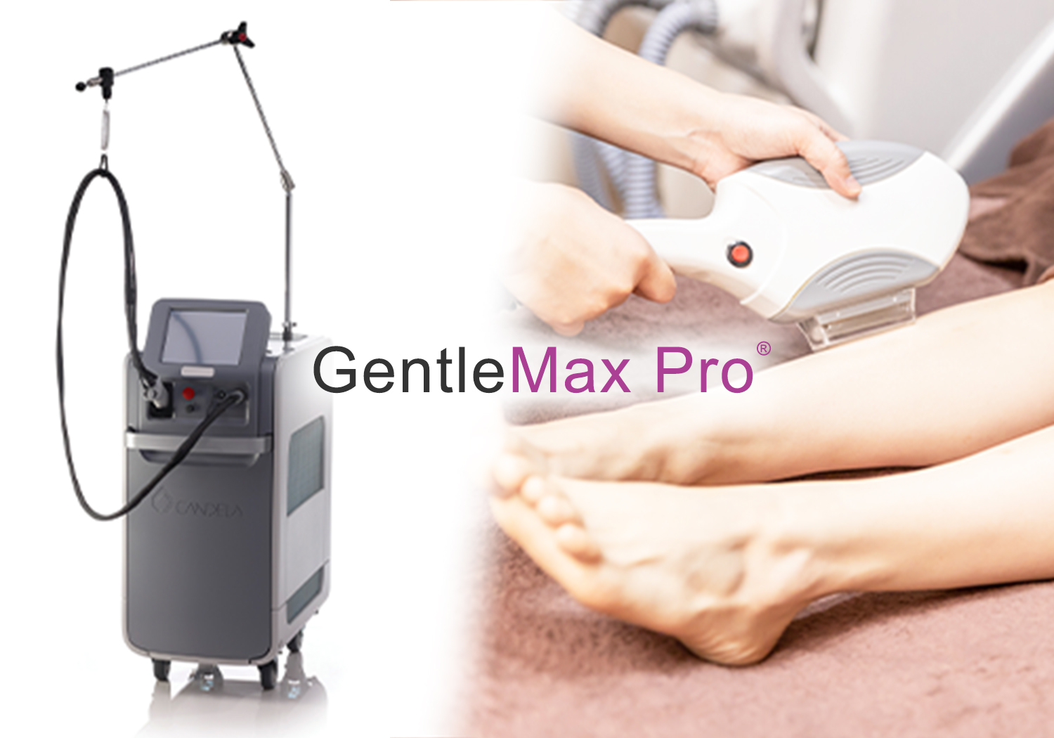 GentleMax Pro