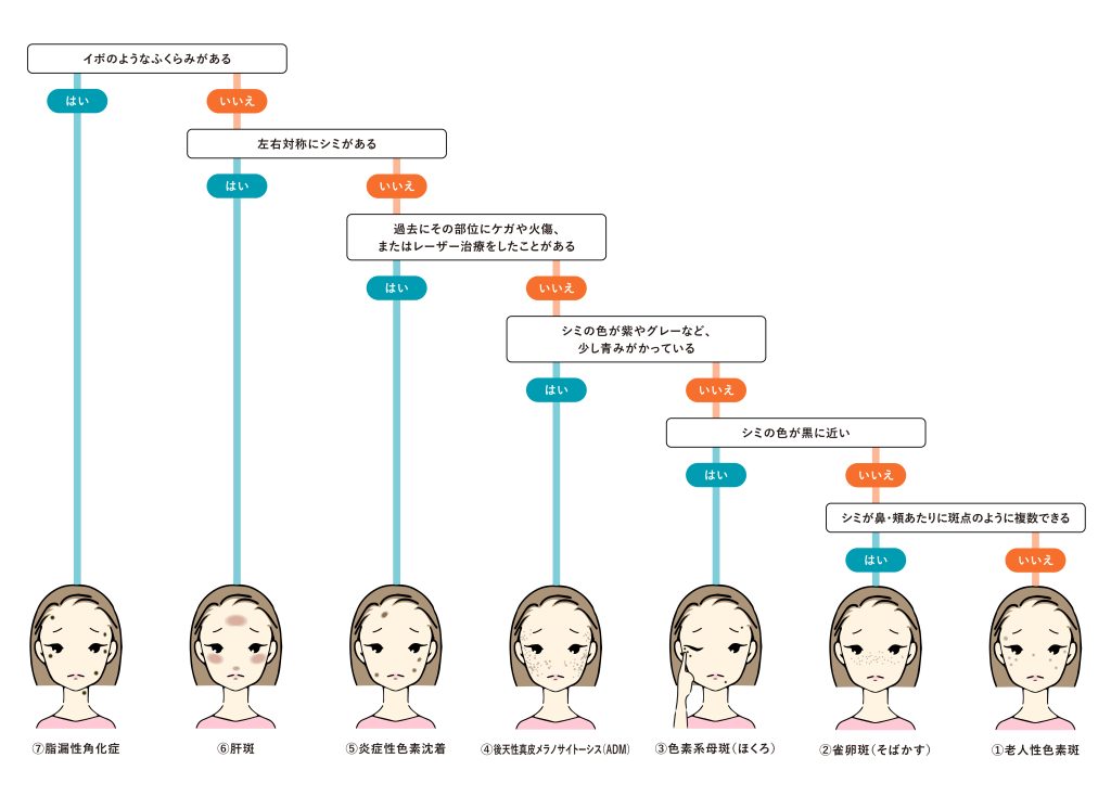 【タイプ診断】シミの種類はひとつじゃない？ あなたのシミの原因は？ | CZEN CLINIC